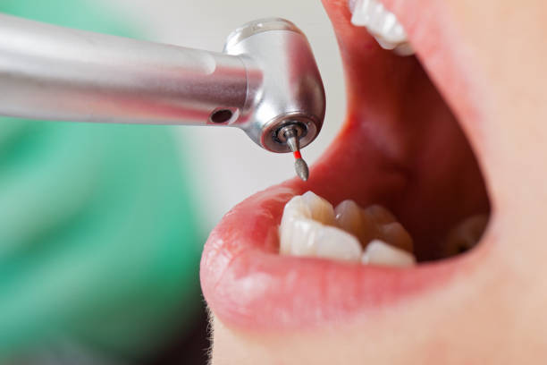 Best Emergency Treatment for Jaw Pain or Injury in Watford City, ND